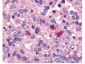 Anti-ARTEMIS (DCLRE1C DNA cross-link repair 1C) [GOAT] Antibody